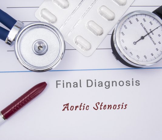 Cтеноз аортального клапана: причины, симптомы, диагностика и лечение