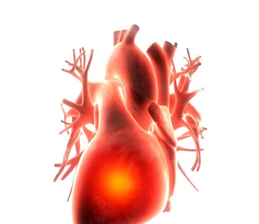 Что такое декстрокардия?