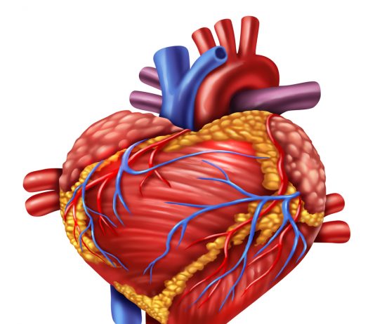 Синдром Бланда-Уайта-Гарланда: что это, симптомы, принципы лечения