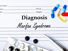 Синдром Марфана: симптомы со стороны сердца и сосудов, диагностика, лечение